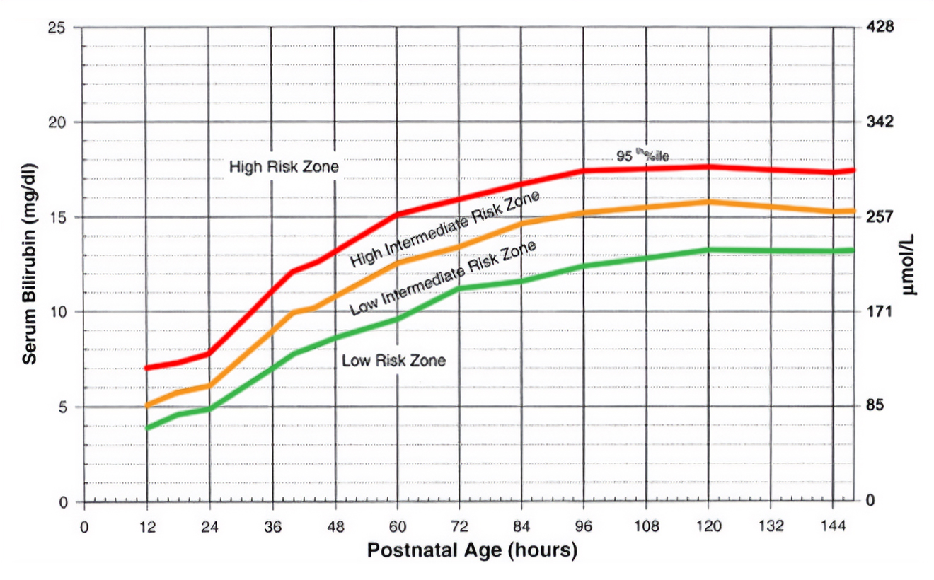 baby jaundice level chart - Captions Domestic